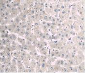 Alpha-1-B-Glycoprotein (a1BG) Monoclonal Antibody - image 5