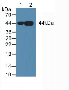 Knockout Varification: <br/>Lane 1: Wild-type HepG2 cell lysate; <br/>Lane 2: ANXA3 knockout HepG2 cell lysate; <br/>Predicted MW: 36kDa <br/>Observed MW: 36kDa<br/>Primary Ab: 3µg/ml Mouse Anti-Human ANXA3 Antibody<br/>Second Ab: 0.2µg/mL HRP-Linked Caprine Anti-Mouse IgG Polyclonal Antibody<br/>
