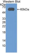 Aldehyde Dehydrogenase 7 Family, Member A1 (ALDH7A1) Monoclonal Antibody - image 2