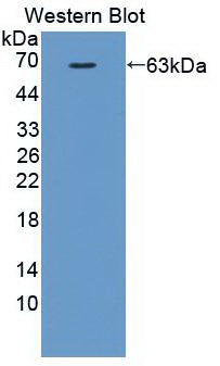 Western Blot; Sample: A431 cell lysate; Primary Ab: 2μg/ml Mouse Anti-Human MMP2 Antibody; Second Ab: 0.2µg/mL HRP-Linked Caprine Anti-Mouse IgG Polyclonal Antibody;
