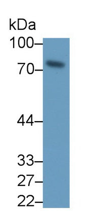 DAB staining on IHC-P; Samples: Human Prostate Tissue;  Primary Ab: 30µg/ml Mouse Anti-Human MMP2 An