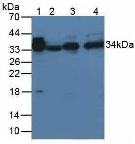 Western Blot; Sample: Recombinant protein.