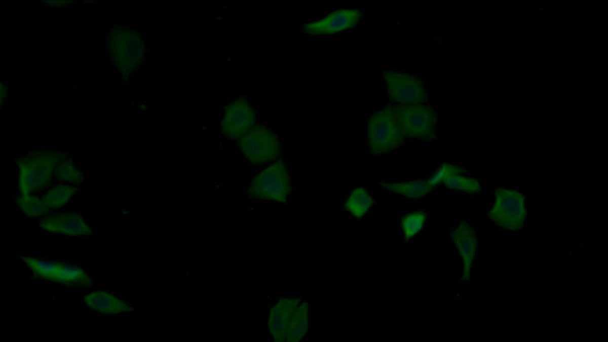 Alpha-2-Glycoprotein 1, Zinc Binding (aZGP1) Monoclonal Antibody - image 5