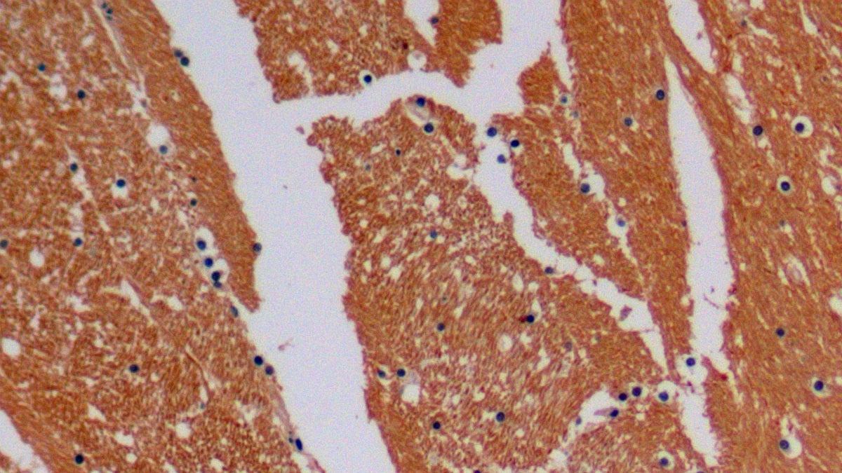 DAB staining on IHC-P Samples:Human Stomach Tissue)