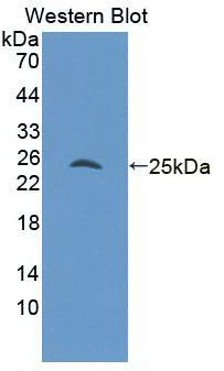 Androgen Receptor (AR) Monoclonal Antibody - image 2