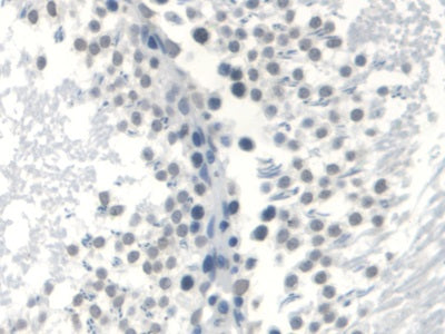 DAB staining on IHC-P Samples:Rat Heart Tissue