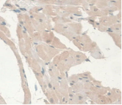 Androgen Receptor (AR) Monoclonal Antibody - image 4
