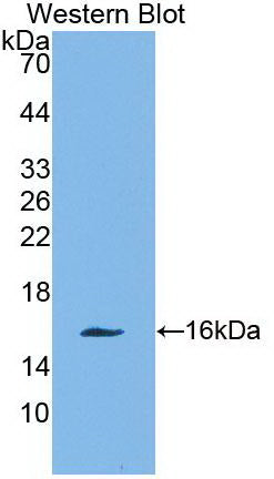 Charcot Leyden Crystal Protein (CLC) Monoclonal Antibody - image 2