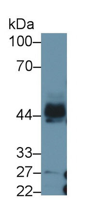 DAB staining on IHC-P; Samples: Human Cerebrum Tissue;  Primary Ab: 30µg/ml Mouse Anti-Human PAI1 An