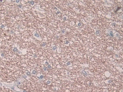 Figure.DAB staining on IHC-P Samples:Human Kidney Tissue