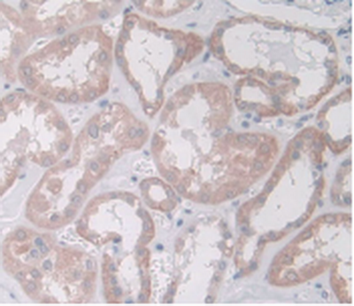 Plasminogen Activator Inhibitor 1 (PAI1) Monoclonal Antibody - image 5