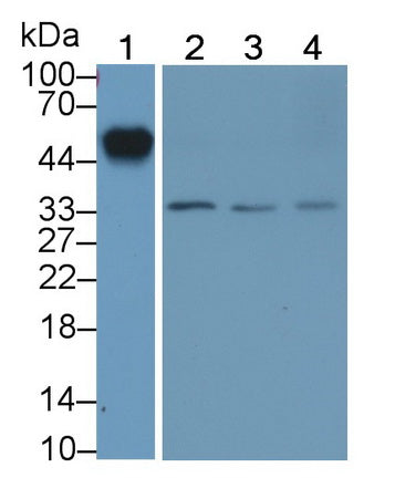 DAB staining on IHC-P; Samples: Human Liver Tissue;  Primary Ab: 30µg/ml Mouse Anti-Human a1AGP Antibody Second Ab: 2µg/mL HRP-Linked Caprine Anti-Mouse IgG Polyclonal Antibody