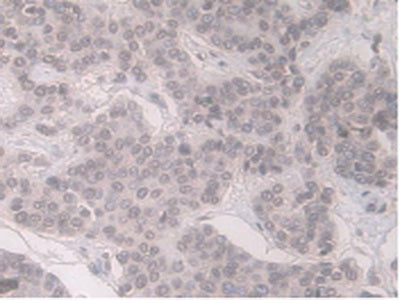 Alpha-1-Acid Glycoprotein (a1AGP) Monoclonal Antibody - image 5