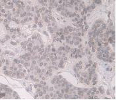 Alpha-1-Acid Glycoprotein (a1AGP) Monoclonal Antibody - image 5