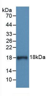 DAB staining on IHC-P; Samples: Human Liver Tissue;  Primary Ab: 40µg/ml Mouse Anti-Human C1INH Antibody Second Ab: 2µg/mL HRP-Linked Caprine Anti-Mouse IgG Polyclonal Antibody