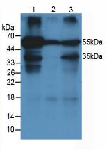 Western Blot; Sample: Rat Cerebrum lysate; ; Primary Ab: 3µg/ml Mouse Anti-Rat a1AGP Antibody; Second Ab: 0.2µg/mL HRP-Linked Caprine Anti-Mouse IgG Polyclonal Antibody;