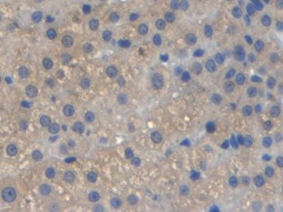 DAB staining on IHC-P; Samples: Rat Heart Tissue.