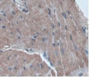 Alpha-1-Acid Glycoprotein (a1AGP) Monoclonal Antibody - image 5