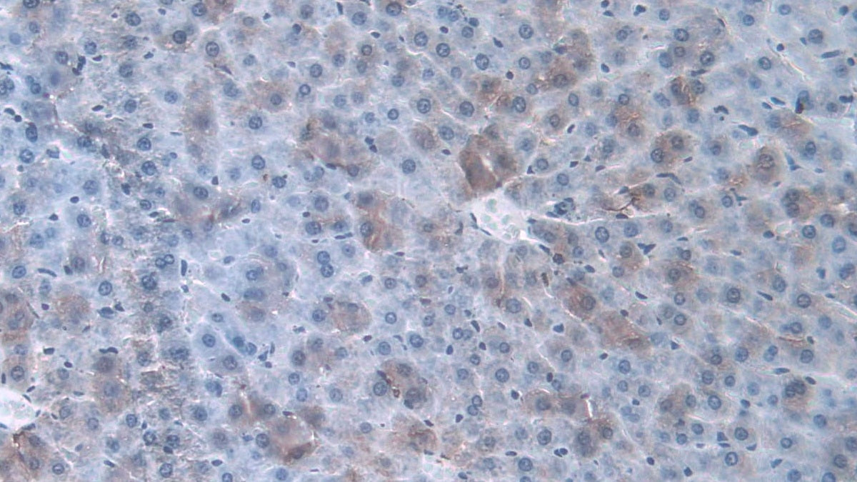 DAB staining on IHC-P; Samples: Rat Heart Tissue.