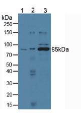 Western Blot; Sample: Human Lung lysate; ; Primary Ab: 1µg/ml Mouse Anti-Human cPLA2 Antibody; Second Ab: 0.2µg/mL HRP-Linked Caprine Anti-Mouse IgG Polyclonal Antibody;