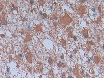 DAB staining on IHC-P; Samples: Human Stomach Tissue.