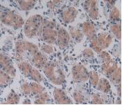 Cytosolic Phospholipase A2 (PLA2G4) Monoclonal Antibody - image 5