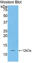 S100 Calcium Binding Protein A5 (S100A5) Monoclonal Antibody - image 2