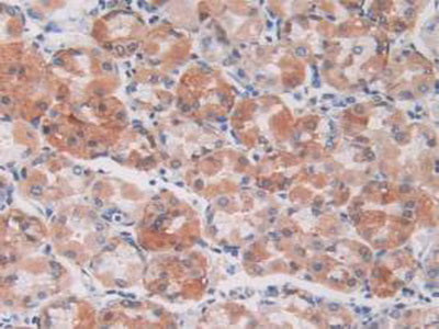 S100 Calcium Binding Protein A5 (S100A5) Monoclonal Antibody - image 4