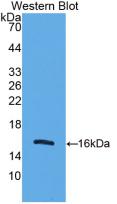 Mitochondrial Uncoupling Protein 2 (UCP2) Monoclonal Antibody - image 2