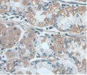 Mitochondrial Uncoupling Protein 2 (UCP2) Monoclonal Antibody - image 4