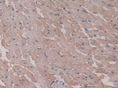 Heat Shock Protein Beta 6 (HSPb6) Monoclonal Antibody - image 5