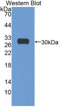 Ki-67 Protein (Ki-67) Monoclonal Antibody - image 2