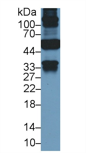 Figure.Western Blot ;Sample: Recombinant KRT19, Human.