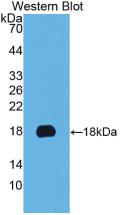 Cytokeratin 19 (CK19) Monoclonal Antibody - image 3