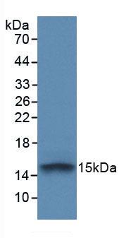 Fibroblast Growth Factor Receptor 1 (FGFR1) Monoclonal Antibody - image 2