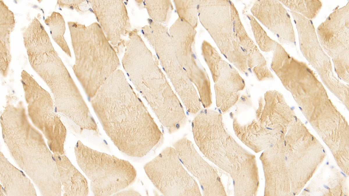 DAB staining on IHC-P; Samples: Human Placenta Tissue; Primary Ab: 20µg/ml Mouse Anti-Human VEGFR2 Antibody Second Ab: 2µg/mL HRP-Linked Caprine Anti-Mouse IgG Polyclonal Antibody