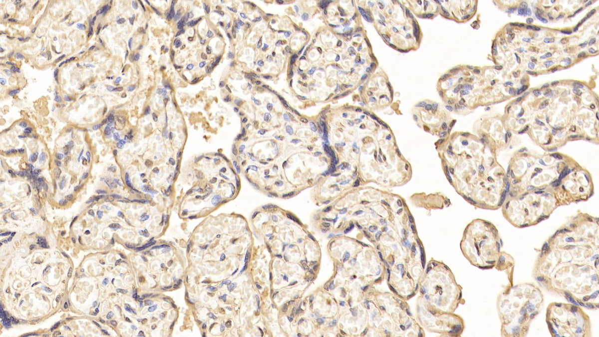 Vascular Endothelial Growth Factor Receptor 2 (VEGFR2) Monoclonal Antibody - image 4
