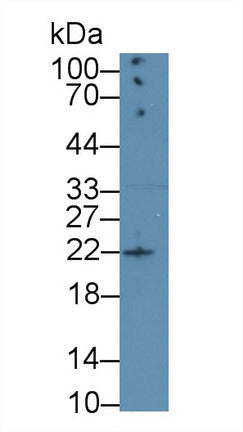 Western Blot; Sample: Recombinant AREG, Human.