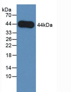 DAB staining on IHC-P; Samples: Human Liver cancer Tissue;  Primary Ab: 20µg/ml Mouse Anti-Human ARE