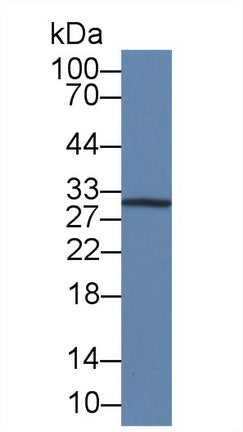 Western Blot; Sample: Recombinant IL12A, Human.