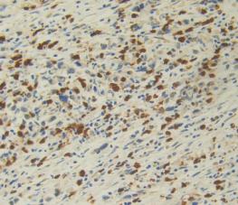 Interleukin 12A (IL12A) Monoclonal Antibody - image 5