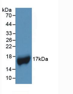 DAB staining on IHC-P; Samples: Human Kidney Tissue; Primary Ab: 30µg/ml Mouse Anti-Human APOA1 Antibody Second Ab: 2µg/mL HRP-Linked Caprine Anti-Mouse IgG Polyclonal Antibody