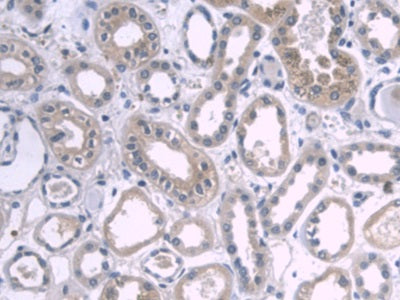 DAB staining on IHC-P; Samples: Human Kidney Tissue.