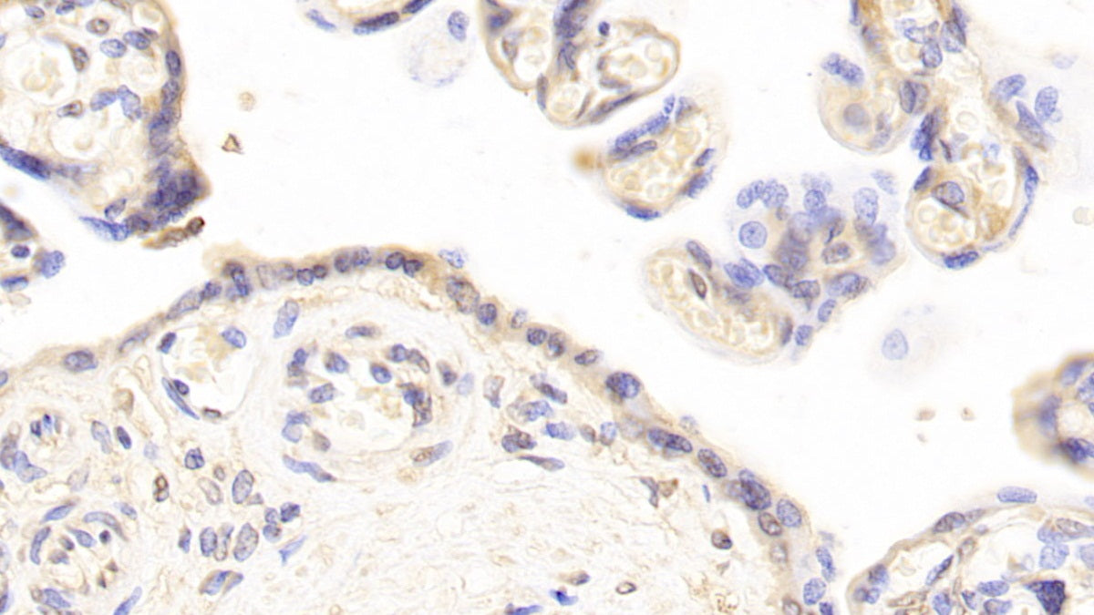 Plasminogen Activator Inhibitor 1 (PAI1) Monoclonal Antibody - image 5