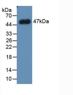Western Blot; Sample: Lane1: Porcine Kidney lysate; Lane2: Human Lung lysate; Lane3: Human Placenta lysate; Primary Ab: 2μg/ml Mouse Anti-Human PAI1 Antibody; Second Ab: 0.2µg/mL HRP-Linked Caprine Anti-Mouse IgG Polyclonal Antibody;