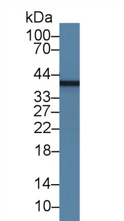 Myelin Basic Protein (MBP) Monoclonal Antibody - image 2
