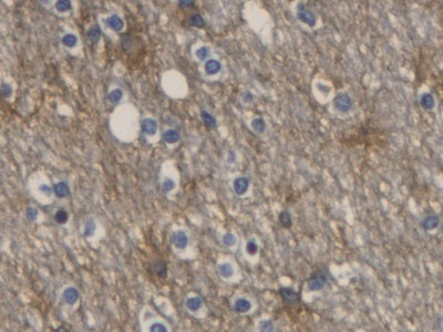 DAB staining on IHC-P; Samples: Human Cerebrum Tissue)