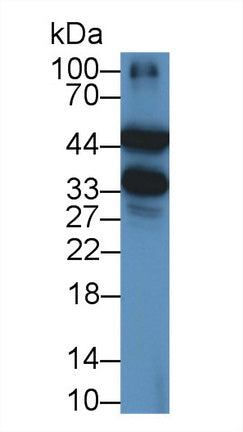 DAB staining on IHC-P; Samples: Rat Liver Tissue; Primary Ab: 30µg/ml Mouse Anti-Rat a1AGP Antibody Second Ab: 2µg/mL HRP-Linked Caprine Anti-Mouse IgG Polyclonal Antibody