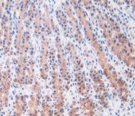 Alpha-1-Acid Glycoprotein (a1AGP) Monoclonal Antibody - image 5