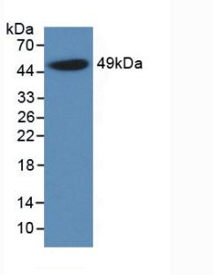 DAB staining on IHC-P; Samples: Rat Liver Tissue;  Primary Ab: 30µg/ml Mouse Anti-Rat a1AGP Antibody